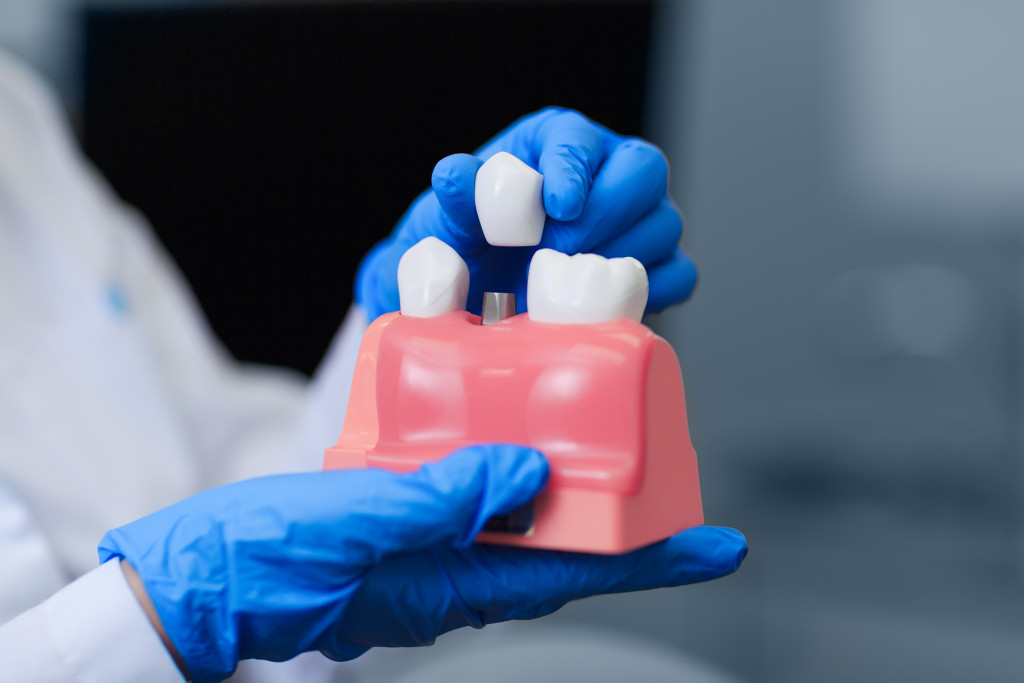 dentist showing dental implant model